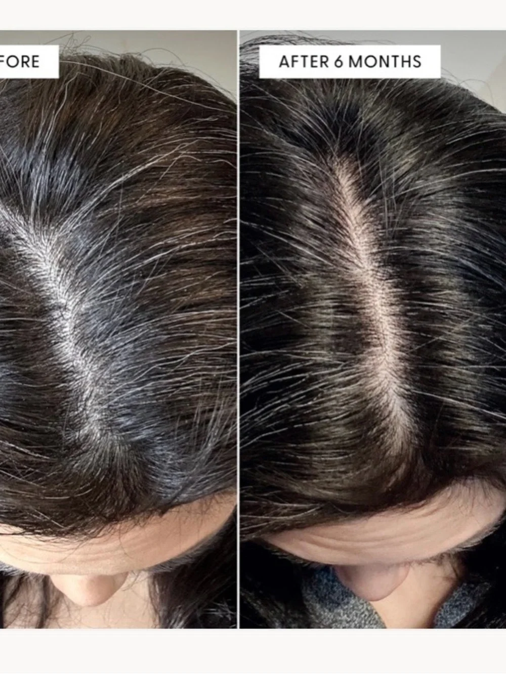 NIB To The Root® Scalp Serum — Anti-Grey & Density Serum 2.2 fl oz